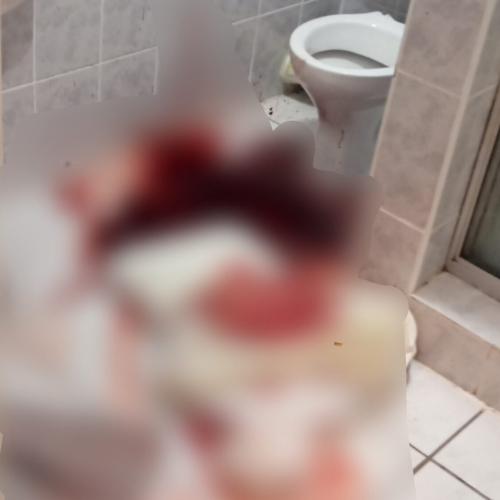 BEFORE – Trauma Clean - Forensic & Biohazard Cleaning | Trauma Clean BEFORE – Trauma Clean